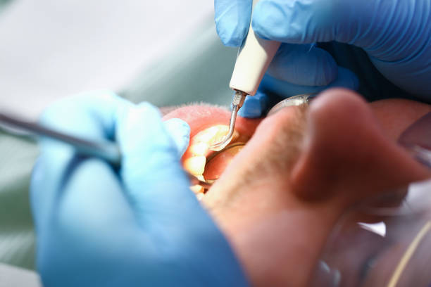 Best Emergency Treatment for Dental Infections or Abscesses in Pennsboro, WV