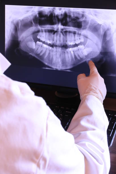 Best Emergency Tooth Extraction in Pennsboro, WV